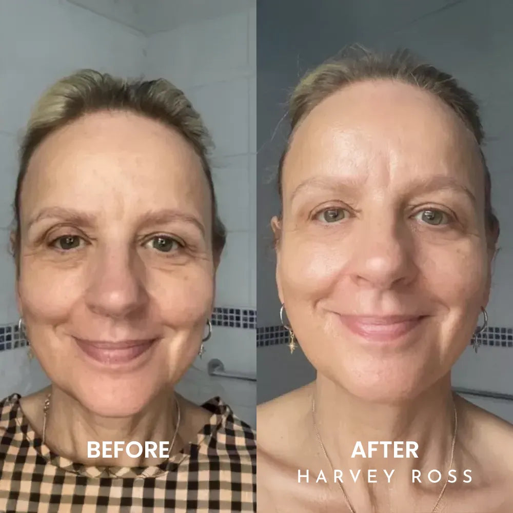 Harvey Ross - Instant Lift+